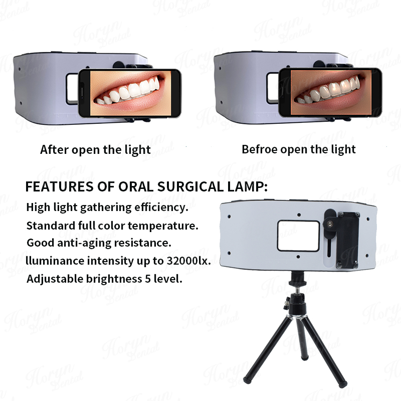 Lampu kilat gigi, peralatan fo - Photography Lighting Equipment ulasan dan harga